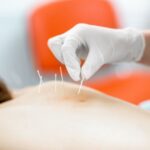Acupuntura: Alívio Natural para Dores e Equilíbrio do Corpo e da Mente